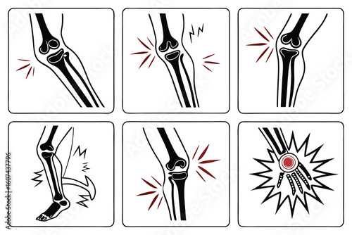 Skeletal joint pain and injury indicators bone medical