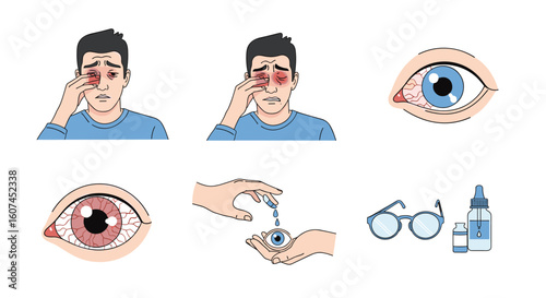 Understanding and treating common eye irritations and redness symptoms with proper eye care solutions
