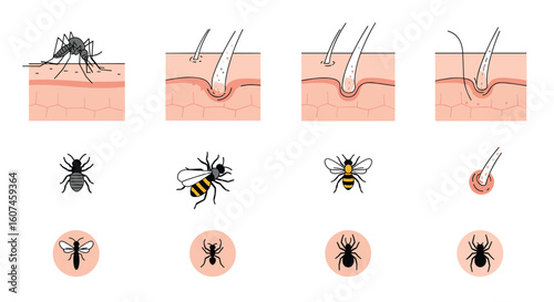 Understanding insect bites and stings how pests affect human skin and cause irritation through various mechanisms and reactions