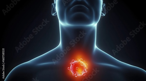 3D illustration of throat cancer cells with red glowing chest circle on faceless man against black background.