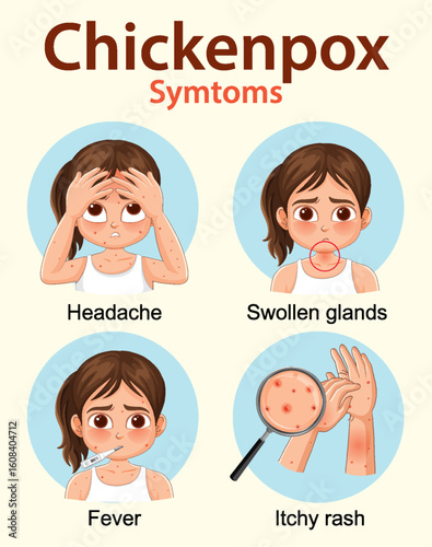 Chickenpox Symptoms Illustrated in Children with Visual Icons