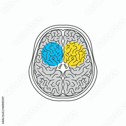 Topdown view of brain with blue and yellow hemispheres