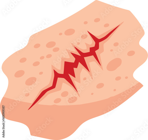 A graphic illustration of a deep, jagged wound with bleeding.