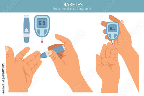 Diabetes. Endocrine diseases. Medical infographic design. Vector illustration
