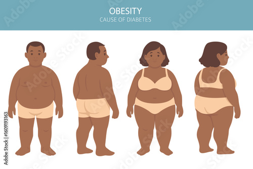 Flat vector illustration of weight loss concept. Before and after body transformation of overweight man and woman. Obese male and female characters shown with slimmer bodies after dieting or fitness. 