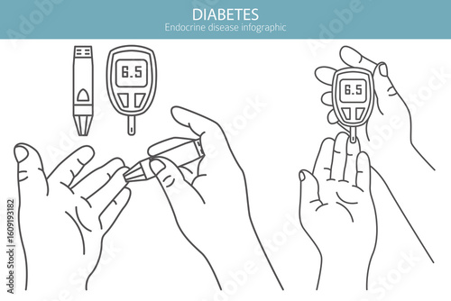 Diabetes. Endocrine diseases. Medical infographic design. Vector illustration