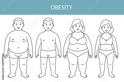 Flat vector illustration of weight loss concept. Before and after body transformation of overweight man and woman. Obese male and female characters shown with slimmer bodies after dieting or fitness. 