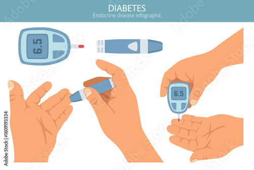 Diabetes. Endocrine diseases. Medical infographic design. Vector illustration