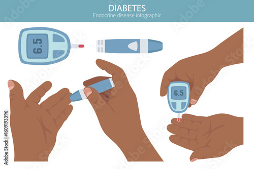 Diabetes. Endocrine diseases. Medical infographic design. Vector illustration