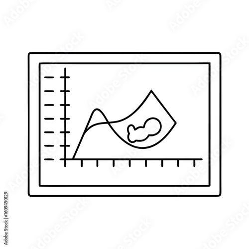 Fetal Growth Scan Illustration Ultrasound Screen with Growing Baby Line Art Design