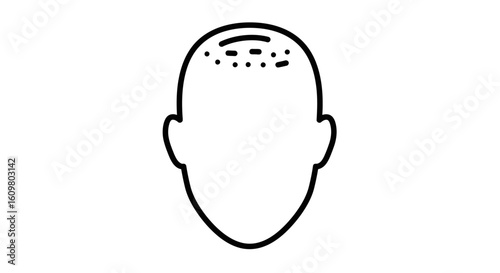 Minimalist line art icon of a head showing male pattern baldness or a receding hairline. Vector graphic for hair loss concept.