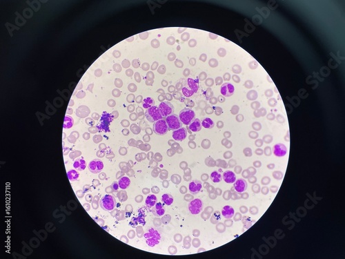 White blood cells (WBCs), also known as leukocytes, are a crucial component of the immune system. They appear as round or irregularly shaped cells with distinct, often lobed nuclei. 