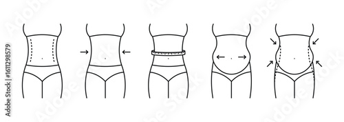 Stages and Effects of Women's Waist Reduction or Body Contouring