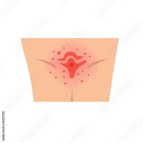 Vector illustration of contact dermatitis symptoms on white background, medical and skin care concept