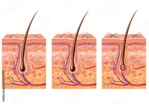 Detailed cross-section of hair follicle stages showing growth, thinning, and shedding with visible blood vessels and skin cells