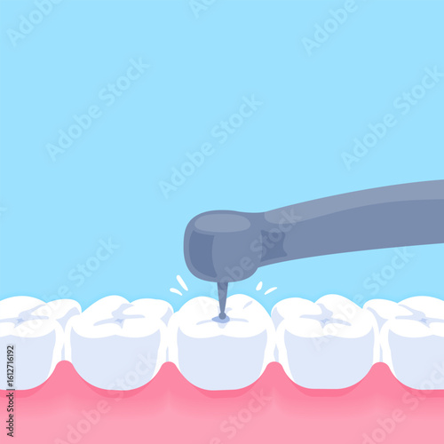 Drill the tooth with dental drill - Text box banner (square) illustration vector design. Dental care concept.
