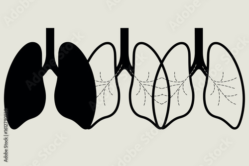 Illustration of healthy and diseased lungs showing progression of illness