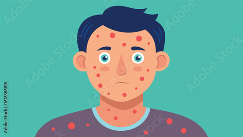 Person with skin rash looking concerned in a simple digital illustration on a light green background
