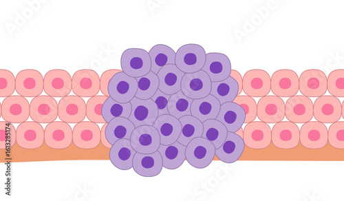 Cancer cells with normal cells on a white background.