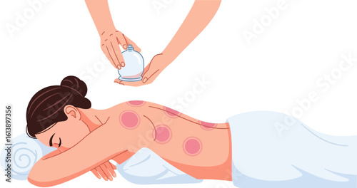 Woman receiving cupping therapy treatment on her back with red marks