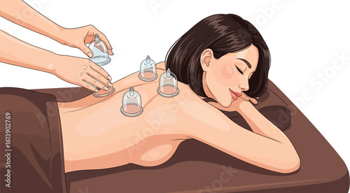 Woman receiving cupping therapy treatment for back pain relief