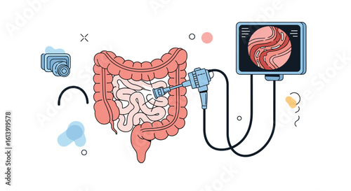 Medical illustration depicting colonoscopy procedure exploring digestive system health and diagnostic examinations