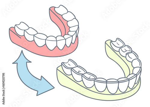 Dentures illustration showing removable teeth appliance for dental care and oral hygiene solution for missing teeth