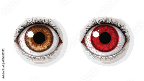 Eye Comparison: Regular vs. Red