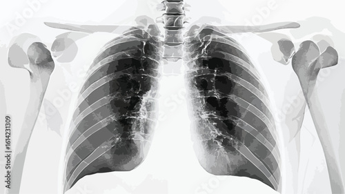 Lung X-ray with white background image