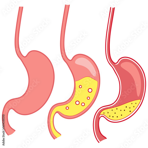 Vector art of illustration showing the different stages of digestion in the human stomach and gastric system
