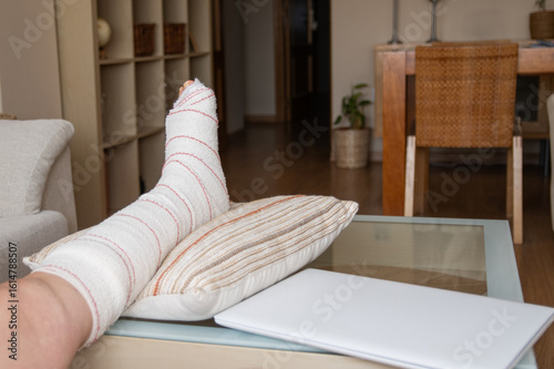 Fotografie Patient recovering from broken leg injury keeps leg elevated on pillow with lapt
