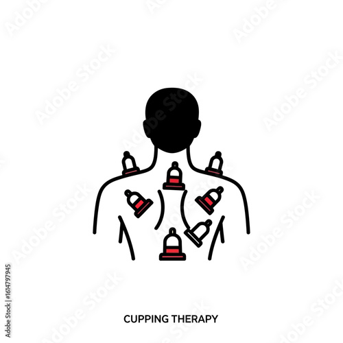 Illustration depicting a person undergoing cupping therapy with suction cups applied to their back.
