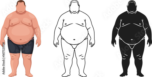 Overweight man illustration: health risk, obesity, weight gain, body mass index, lifestyle choices