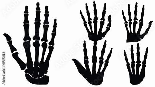 Medical x-ray hand skeleton silhouettes, black bone anatomy vector icons EPS for orthopedics radiology and education