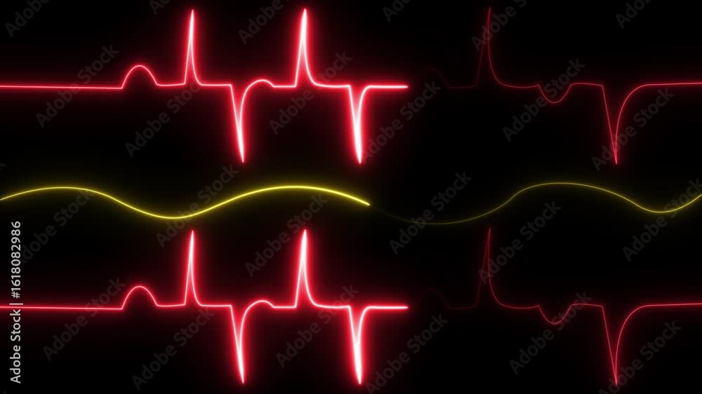 Spo2 Gif Looped: Patient monitor displays vital signs ECG electrocardiogram EKG ...