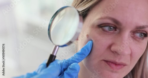 Doctor in gloves holds magnifying glass to woman cheek focusing on mole. Dermatological examination of skin health and detection of skin conditions