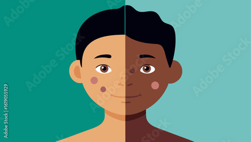 Even Skin Tone An illustration featuring a face with uneven pigmentation and dark spots on one side and the other side showcasing a clear even skin tone after treatment.