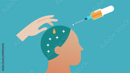 Exosome Delivery A vector depicting a hand applying a serum to the scalp with visual arrows indicating exosomes interacting with hair follicles to promote growth.