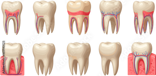 Detailed tooth anatomy illustration, showcasing internal structures and dental conditions for educational purposes.