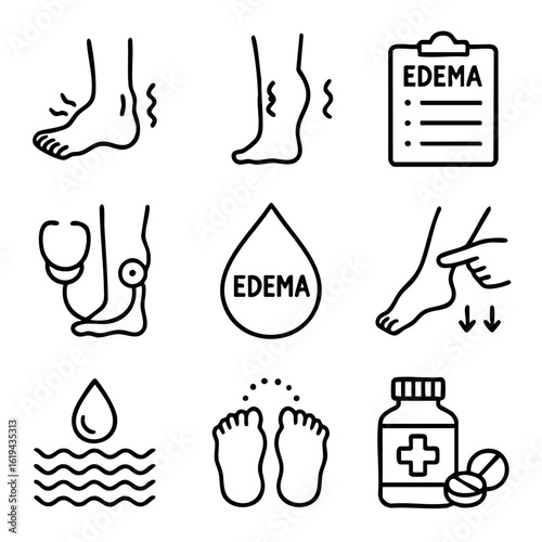 A set of doodle line icons illustrating edema symptoms, swelling in feet, fluid retention, diagnosis, and medical treatment solutions
