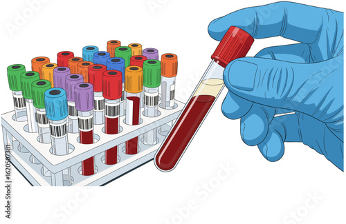 Doctor hand taking a blood sample tube from a rack in the White background. Technician holding blood tube test in the research laboratory.  