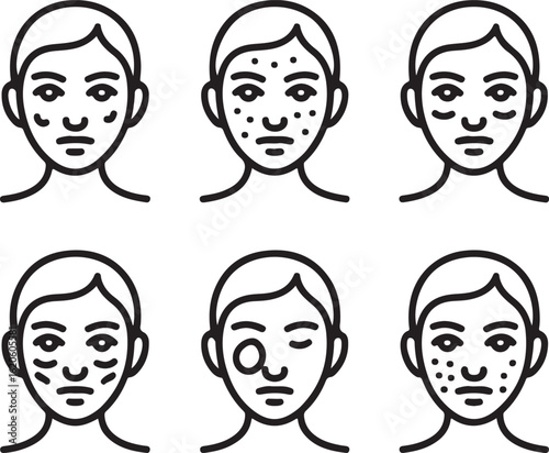 Skin Type & Concern Outline Icon Set – Oily Skin, Dry Skin, Acne, Redness, Wrinkles, Dark Circles, and Sensitive Skin
