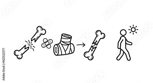 Monochrome Line Art Depiction of Bone Fracture Healing Process Bandage, Progressing to Complete Recovery and Person Walking in the Sun, Medical Illustration, hand drawn, sketch, line art, outline