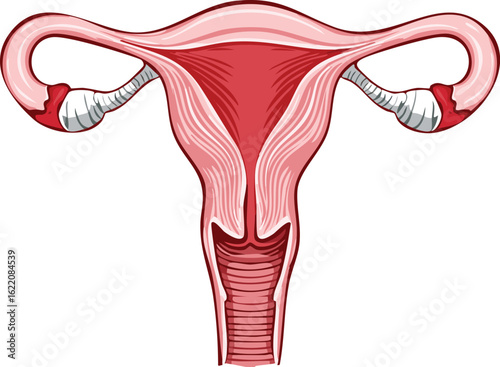 Anatomical illustration of the female reproductive system, showing the uterus, fallopian tubes, and ovaries.