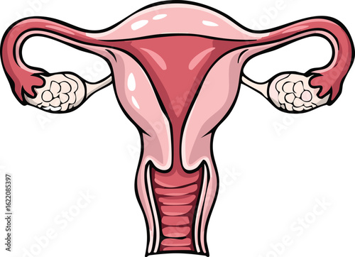 Detailed anatomical illustration of the female reproductive system, showcasing the uterus, fallopian tubes, and ovaries.