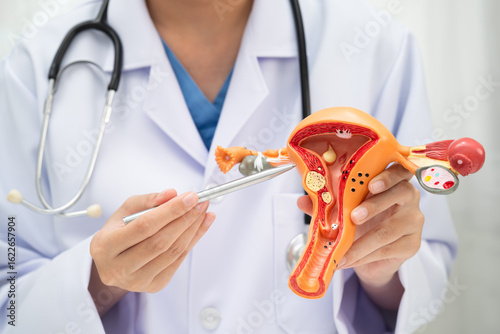 Uterus, doctor holding human anatomy model for study diagnosis and treatment in hospital.