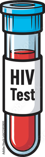 HIV test sample in a laboratory tube.