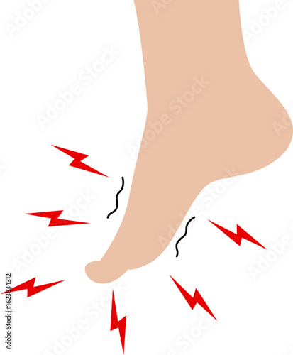 Inflammation Ankle Joint Foot Illustration