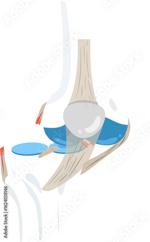 medial dislocation