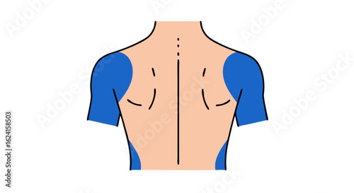Anatomical Illustration of Upper Body: Shoulder and Upper Arm Pain Depiction for Medical Visual Communication